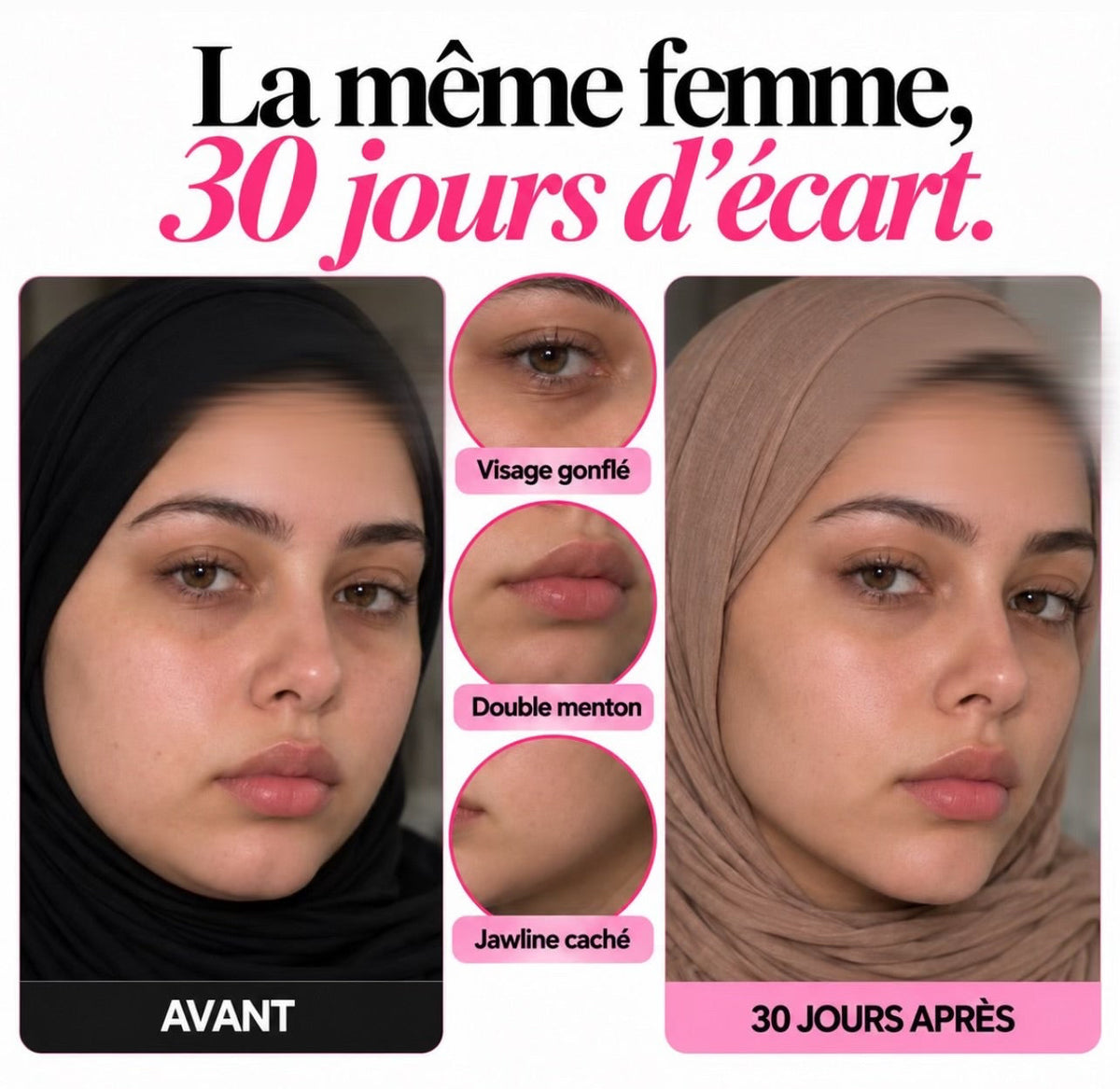 Facial sculpt